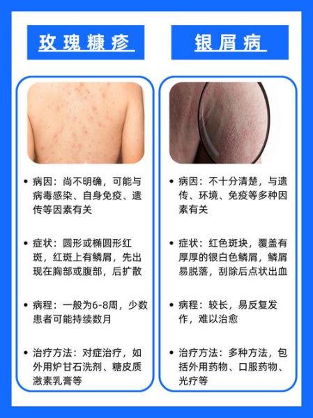 皮肤病变会传染吗_如何区分良性与恶性