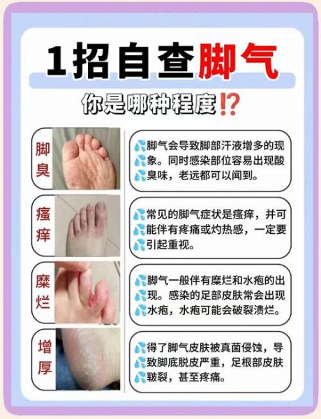 脚臭怎么根治_脚痒是脚气吗